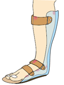 装具のチェックポイント