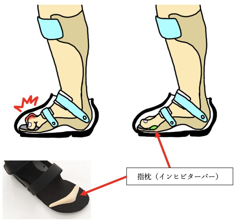 足の指が痛い。指枕