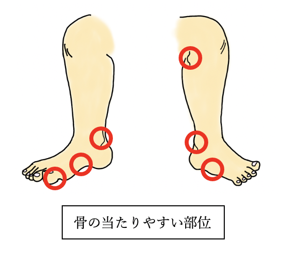 骨のあたりやすい部位