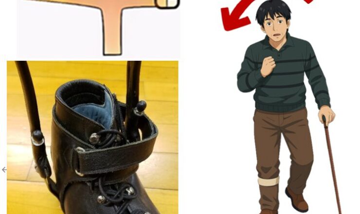 足関節内反が原因で生じる異常歩行を見逃していませんか？～内反への誰でも使える対処法！装具に追加するTストラップを詳しく解説！～