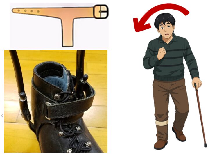 足関節内反が原因で生じる異常歩行を見逃していませんか？～内反への誰でも使える対処法！装具に追加するTストラップを詳しく解説！～ - ゲイトソリューション、長下肢、作製等