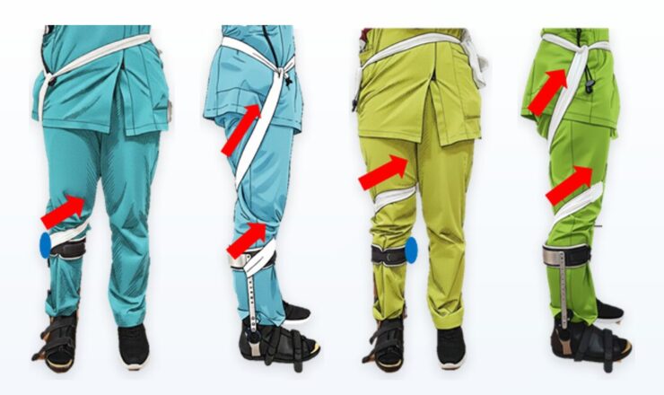 外旋歩行を整える：下肢回旋を補正するツイスターの選び方と活用方法