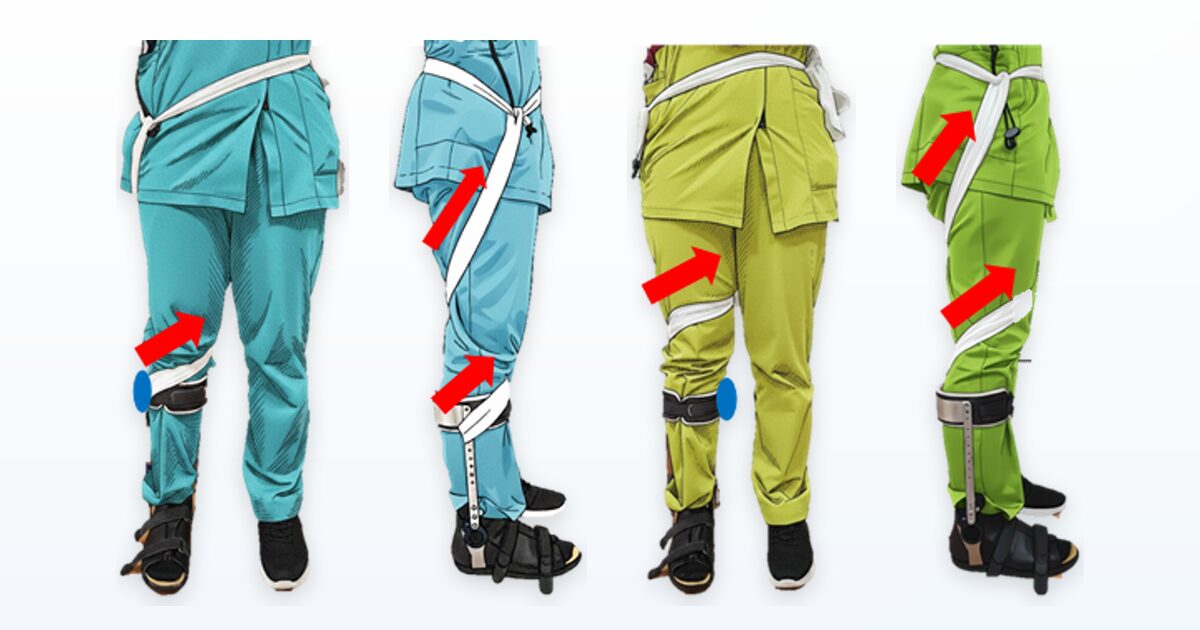 外旋歩行を整える：下肢回旋を補正するツイスターの選び方と活用方法 - ゲイトソリューション、長下肢、作製等