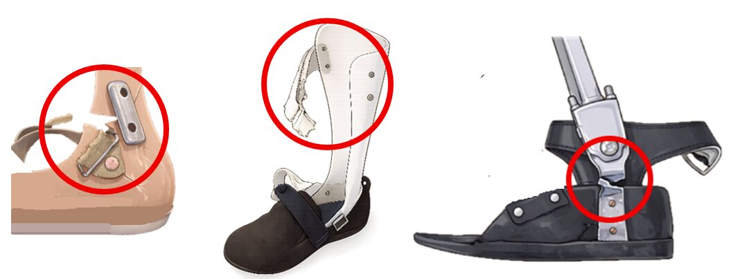 装具が壊れた!? そんな時どうする？～装具破損時の対応と判断ポイント～ - ゲイトソリューション、長下肢、作製等